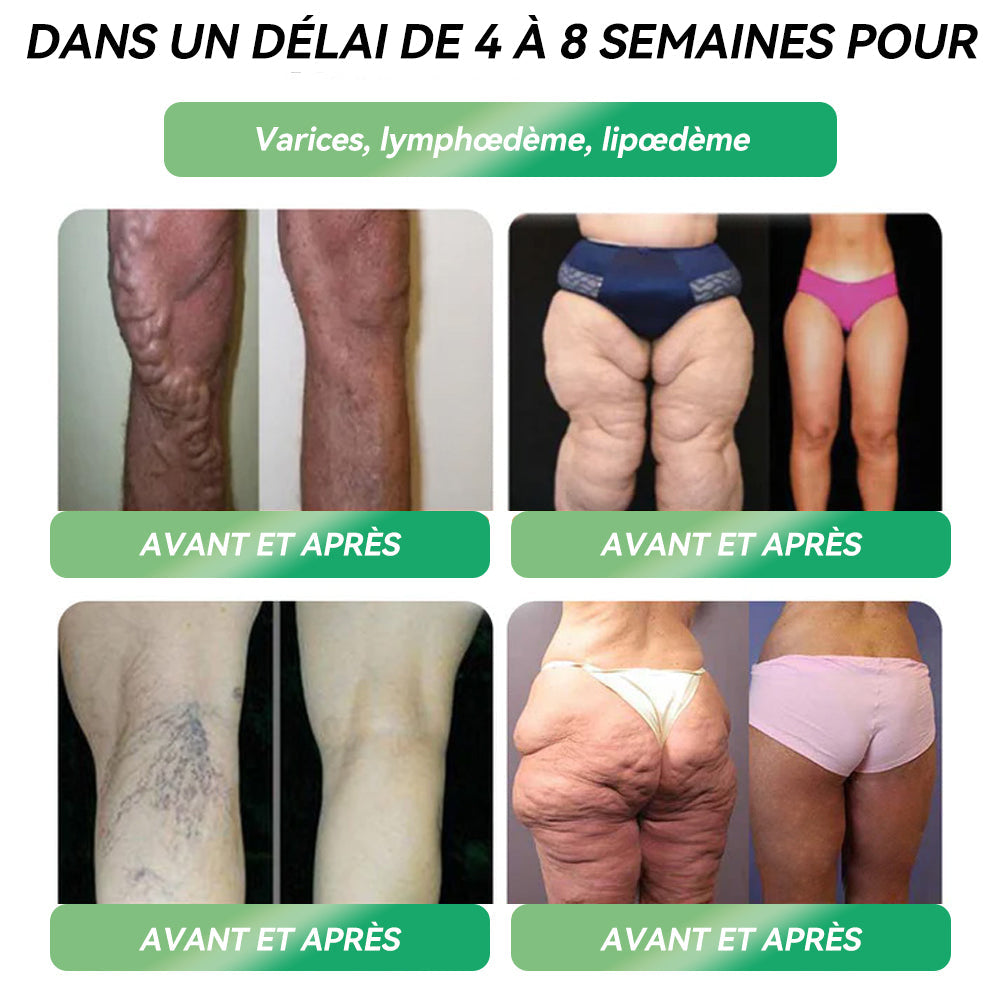 ⭐Vente directe en magasin phare recommandée par l'ANSM LERCEA® GLP-1 ampoule buvable équilibre métabolique Obésité, maladies cardiovasculaires, diabète, syndrome d'apnée du sommeil, problèmes articulaires, etc.🔥🔥