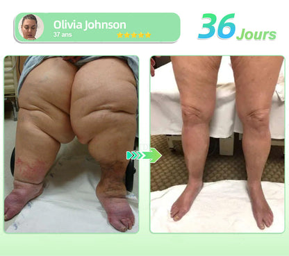🎁 Remise de 30 % sur 𝐋𝐄𝐑𝐂𝐄𝐀® GLP-1 Solution Orale pour la Perte de Poids 🎁